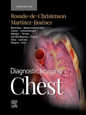 cover image of Chest